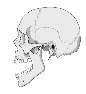 MandibleDislocation: 